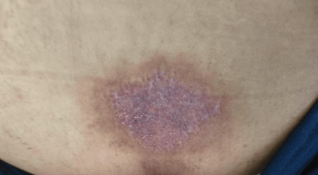 皇冠信用网怎么申请_14岁女孩在拓展营遭体罚去世皇冠信用网怎么申请,班主任因截留其给父母信件受审