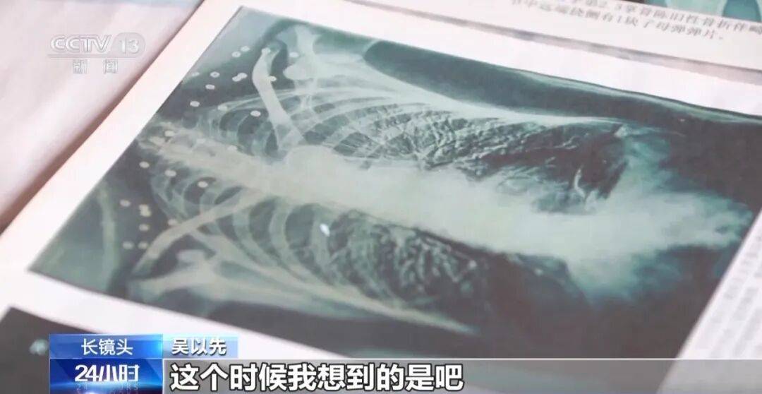 皇冠信用怎么弄
_“老先生皇冠信用怎么弄
,您把项链取下来再做CT”“你看是不是弹片”